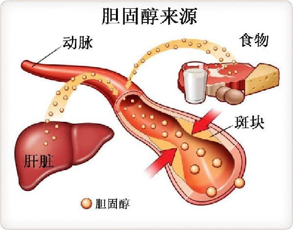 膽固醇飲食多普勒廠(chǎng)家.jpg